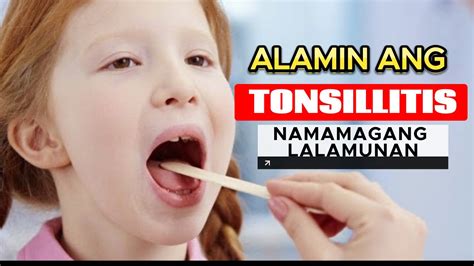 tonsilitis gamot